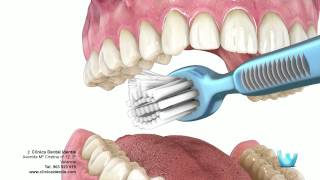 Higiene dental  Clinica identis [upl. by Gilbart]