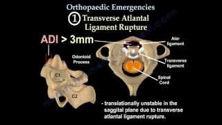 Orthopaedic Trauma for med students 1 [upl. by Eatnoj429]