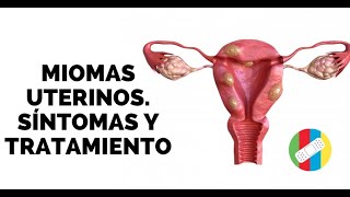 MIOMAS UTERINOS Síntomas y Tratamiento [upl. by Chiles]