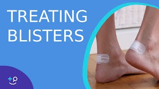 Treating Blisters  Daily Dos of Dermatology [upl. by Anileda]