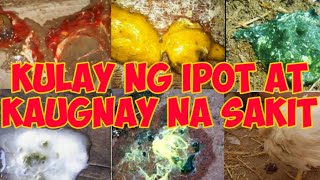 Kulay ng Ipot at Kaugnay na Sakit Anong Gamot [upl. by Tali]