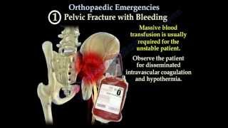 Knee Injection amp Aspiration Technique using Superolateral Patella Approach [upl. by Franchot254]