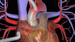 The Cardiovascular System An Overview [upl. by Seabrook834]