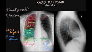 RADIOLOGIE  01 Imagerie ostéoarticulaire [upl. by Joiner873]