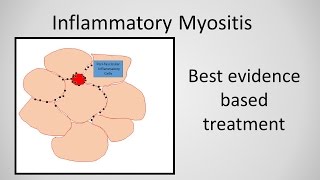 Syndrome Myopathy [upl. by Assej350]