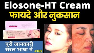 चहरे को गोरा करे Elosone HT Skin Cream  Elosone HT Cream ke fayde  Elosone ht cream uses in hindi [upl. by Crocker]