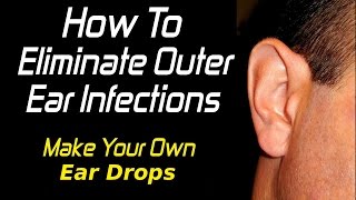 How To Treat Outer Ear Infections [upl. by Ja]