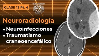 134  Neuroradiología Neuroinfecciones y Traumatismo Craneoencefálico [upl. by Amron]