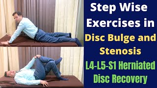 Exercises For Herniated Disc Disc Bulge L4L5S1 Step Wise Treatment for Slipped Disc Recovery [upl. by Ennasirk]