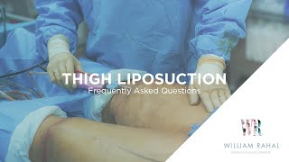 Thigh Liposuction Recovery amp other FAQs Frequently Asked Questions [upl. by Nylrak]