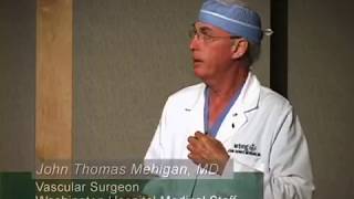 Lapiplasty bunion surgery 6 week post surgery part 2 [upl. by Sudnak]