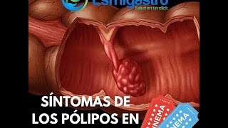 Síntomas de Pólipos en el Colon [upl. by Scarrow66]