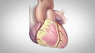 Vein amp Vascular Surgery  Western Vascular Institute [upl. by Ernald408]