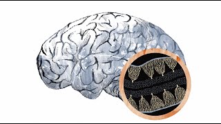 Inside the autism brain The cerebellum [upl. by Annot]