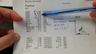 Hematology How to interpret automated Complete Blood Count CBC results [upl. by Zug]