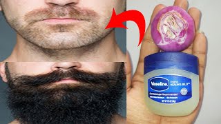 How to grow beard faster naturally at home with onion and vaseline  Beard growth oil [upl. by Darian690]