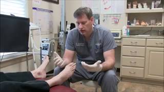 Treating Toenail Fungus with Lamisil [upl. by Ahsuas787]