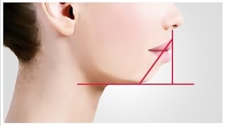 What Is A Recessive Chin By Dr Mike Mew [upl. by Ilise]