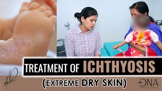 What is ichthyosis  Ichthyosis Causes Symptoms amp Treatment  Dr Priyanka Reddy [upl. by Ateloj]