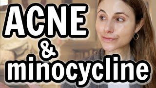 Minocycline versus doxycycline for acne Dr Dray [upl. by Acirtal679]