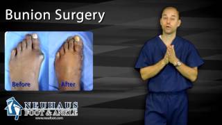 What To Expect After Bunion Surgery [upl. by Ailad71]