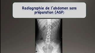 DTS Imagerie Médicale et Radiologie Thérapeutique IMRT [upl. by Animsay]