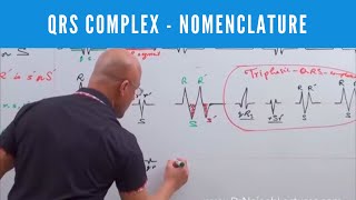 ECG  QRS Complex in EKG  Nomenclature  Electrocardiography🫀 [upl. by Zara]