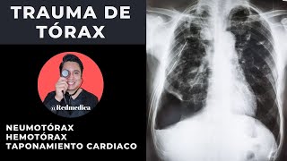 ATLS  Trauma de tórax  ENARM2021  🩺Dr Treviño [upl. by Airekat]