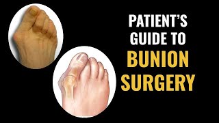 Patients Guide to Bunion Surgery [upl. by Countess]