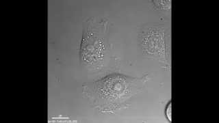 Keratinocyte cell movements [upl. by Fleece]