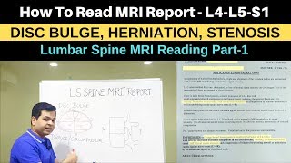 How to read MRI Report Lumbar Spine MRIL4L5S1 MRI for low back pain SciaticaHerniated Disc MRI [upl. by Attalanta725]