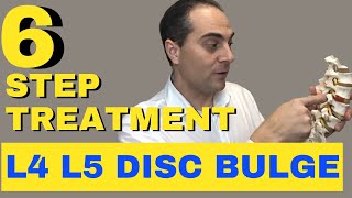 6 Step L4 L5 Disc Bulge Treatment L4 L5 Bulging Disc Treatment by Dr Walter Salubro [upl. by Kciremed112]