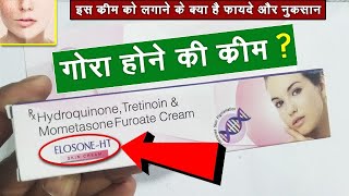 Eloson HT cream  गोरा होने की क्रीम  Review uses and side effects  How to use on skin  हिंदी [upl. by Annayoj]