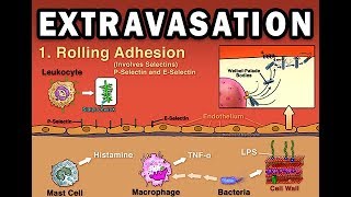 EXTRAVASATION [upl. by Eimarej659]