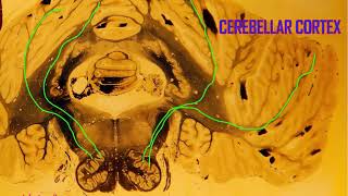 Purkinje cells in the cerebellum [upl. by Spear278]