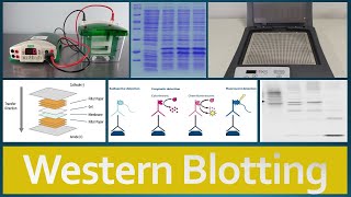 Western Blotting  Principle Procedure and Applications [upl. by Neelehtak]