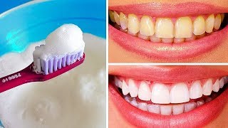 10 formas naturales de blanquear los dientes amarillentos en casa [upl. by Sherrod]