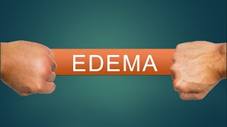 FISIOPATOLOGIA DEL EDEMA [upl. by Waldo]