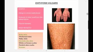 Ichthyosis Vulgaris [upl. by Aytac]