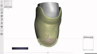 Prosthetic Socket Design [upl. by Ezequiel76]