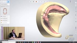 Digital Dentures A Crash Course on How to Design using 3Shape  Logan Woomer [upl. by Killigrew]