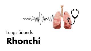 Rhonchi  Lung Sounds  Medzcool [upl. by Tdnarb]