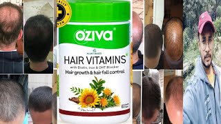 Oziva Hair Vitamins Capsule Review In Hindi [upl. by Aenel]