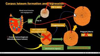 Ovarian Cysts Symptoms Complications amp Treatments  Pearl Womens Center [upl. by Andersen830]