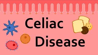 Celiac Disease 2021 Update [upl. by Onitram]