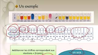 Interprétation de la galerie API 20E [upl. by Areic]