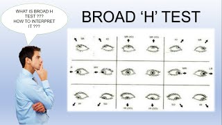 Broad H Test  Ocular Motility Test [upl. by Ingamar]