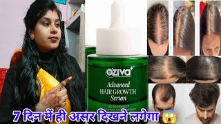 Oziva Advance Hair Growth Serum Honest Review  Oziva advance hair growth serum review in hindi [upl. by Droffig]