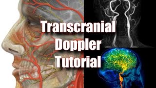 Transcranial Doppler Tecnique Anatomy amp Protocol [upl. by Gamal]