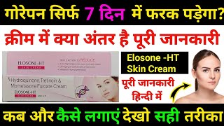 Hydroquinone Tretinoin amp Mometasone Furoate CreamElosoneHT Skin Cream गोरेपन सिर्फ 7 दिन में [upl. by Eenehs727]